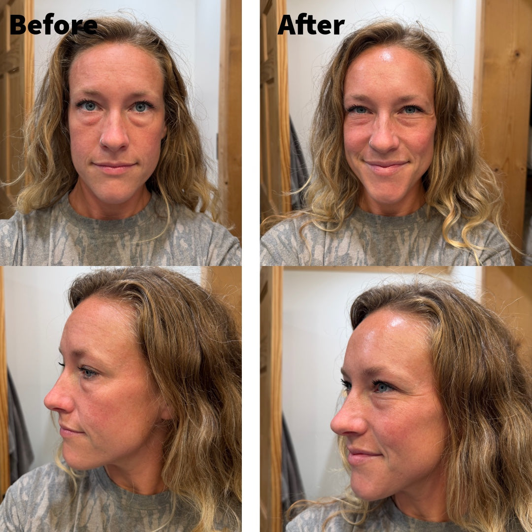 Firm AF before and after product demonstration